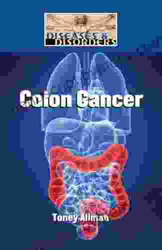 Colon Cancer (Diseases And Disorders)